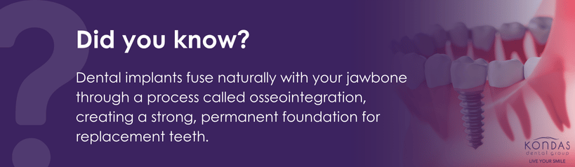 Informational image explaining what dental implants are and how they work