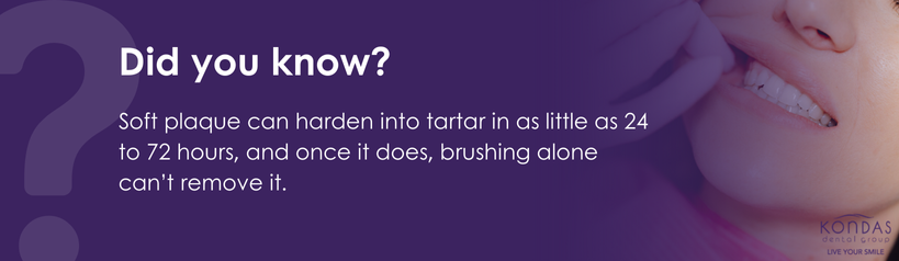 Hard plaque buildup on teeth showing tartar that cannot be removed by brushing alone.